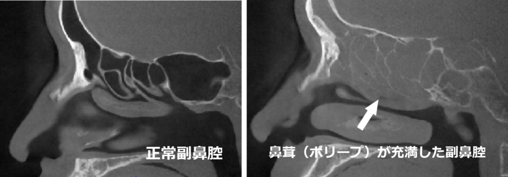 CT検査
